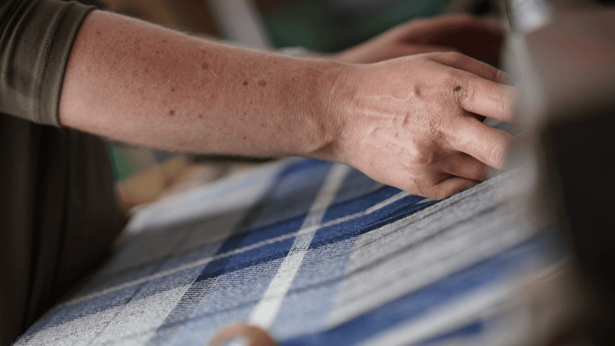 Support Your Skin: The Truth about Wool Allergies - Prickly Thistle